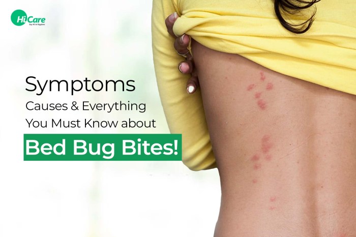 Bugs