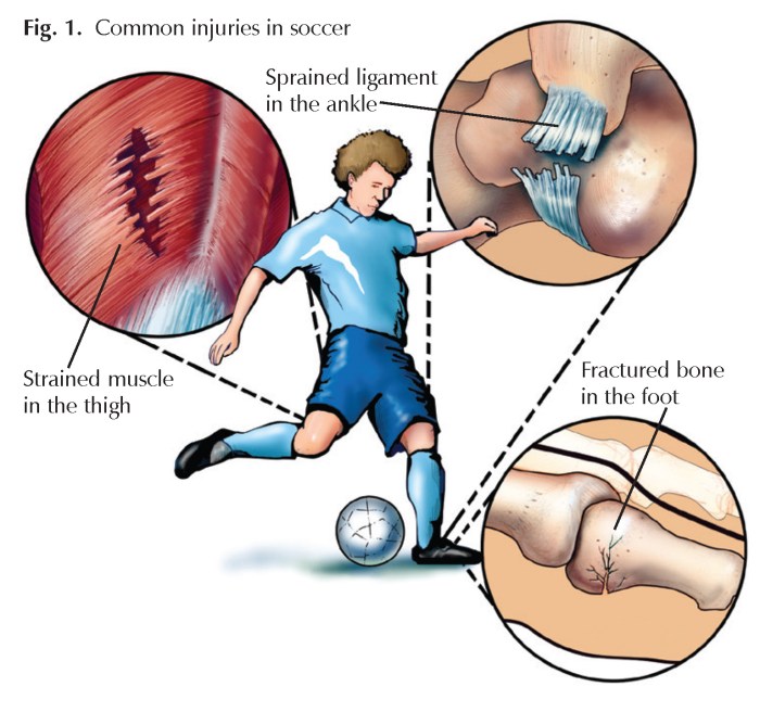 Injury Injury